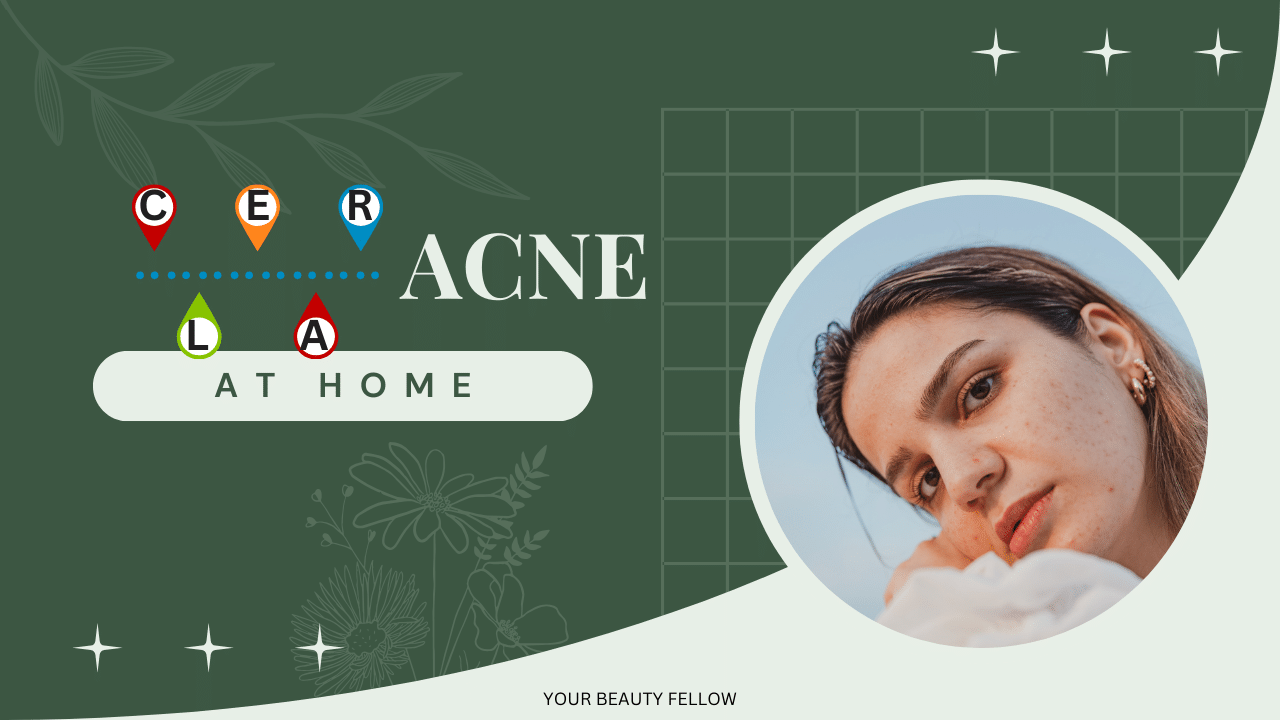 Acne Treatments at Home_AI Skincare Coach