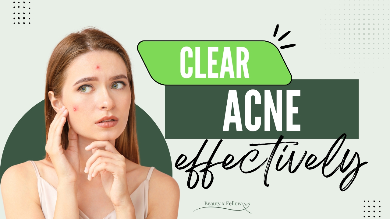 clear acne effectively