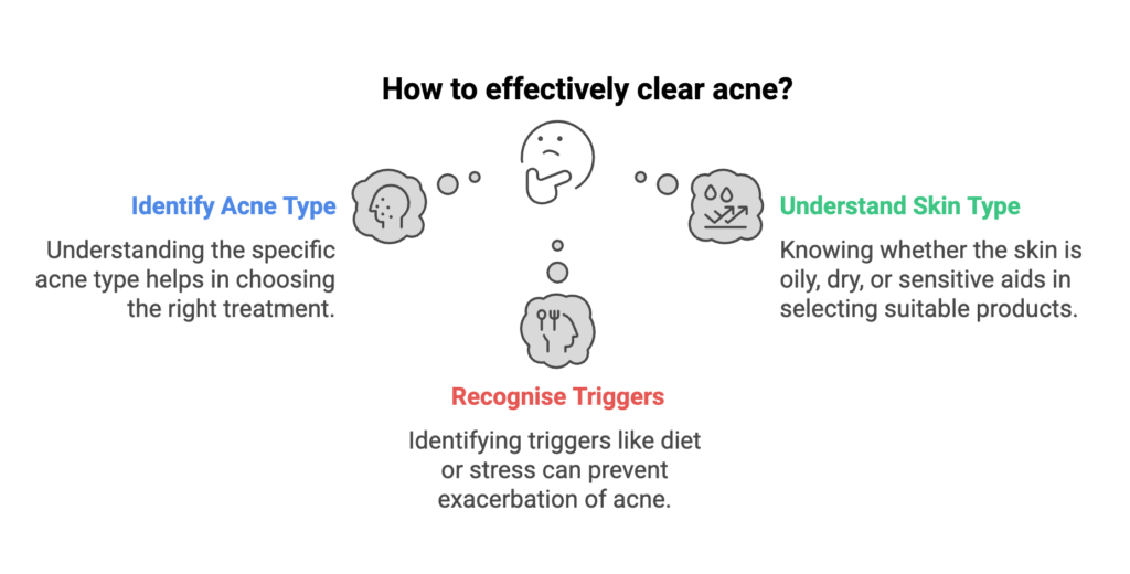 how to clear acne effectively