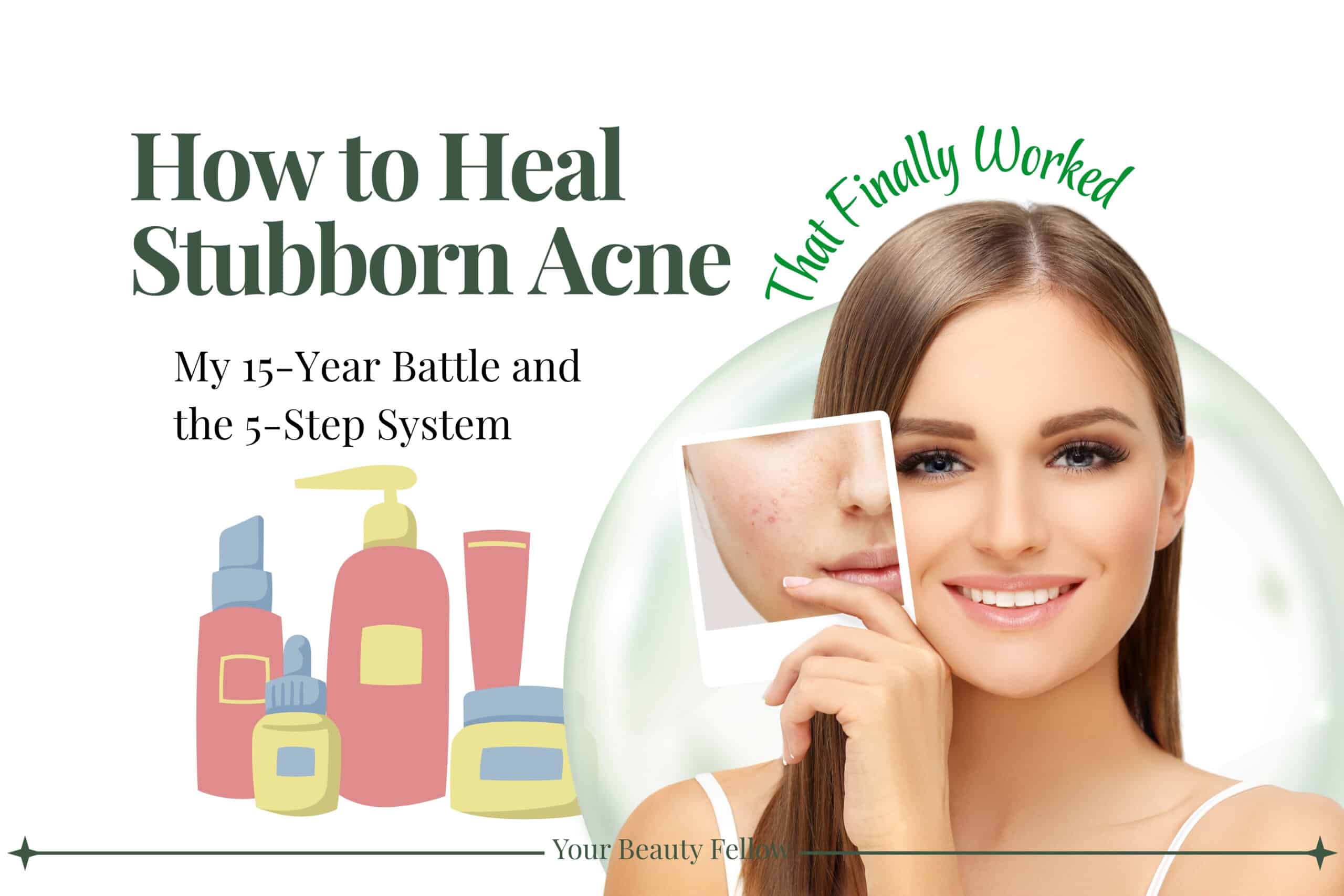 How to Heal Stubborn Acne